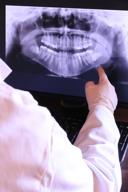 Best Emergency Tooth Extraction  in Ormond By The Sea, FL