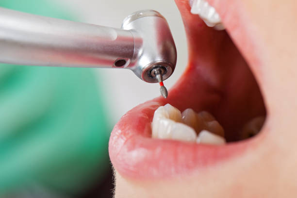 Best Tooth Infection Emergency Dentist  in Ormond By The Sea, FL